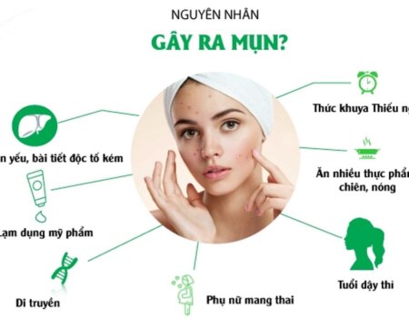 Skincare Routine Cho Da Dầu Mụn Đầy Đủ Bước Và Sản Phẩm