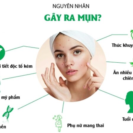 Skincare Routine Cho Da Dầu Mụn Đầy Đủ Bước Và Sản Phẩm