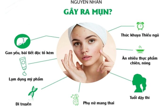 Skincare Routine Cho Da Dầu Mụn Đầy Đủ Bước Và Sản Phẩm